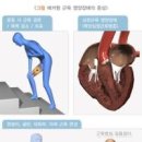 엉덩이 통증 원인과 관리법 이미지