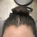 [하남 미사역] 두피 고민 해결? 웰킨두피탈모센터 리얼 방문 후기!