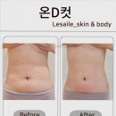 레젤스킨 & 바디