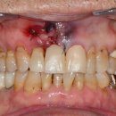 리온치과기공소 이미지