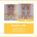 이젠드림가정의학과의원 | 혈관염 치료, 무조건 대학병원 가면 될까? 방문 전 2가지 확인하세요.