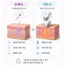 황금동 쥬베룩 리투오, 모공 스킨부스터 선택 기준은? 이미지