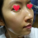 베네핏 에스테틱 이미지