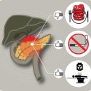 위장약 먹어도 소화 안 되고 복통 땐 췌장암 의심해야 이미지