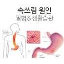 속쓰림 원인 위가 속 쓰릴때 응급처치 (명치 위통증, 아침공복 식후) 이미지