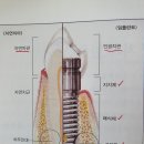 靑松 건강칼럼 (807)... 長壽를 위한 齒牙관리 이미지