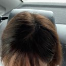자연생활어린이집 | 전주문신부터 전주두피관리까지 자연스러운 변화로 자신감 찾은 후기