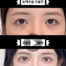 아이그램성형외과의원 이미지