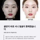 송천동 전주 피부관리샵 사무직 여성 90일간 자세 무너진 결과