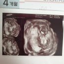 은희목장 | 아기랑 제주 한달살기 후기(21년 4월)/ABC탁송/갈만한곳/맛집/산부인과/숙소 추천(feat. 나는야 임산부)
