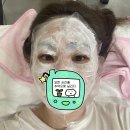 미앤지의원 | 내돈내산 미앤지의원 얼굴 전체 잡티제거 후기 (편평사마귀,주근깨,점)