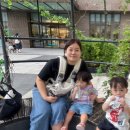 길동중앙약국 | 켈로이드 피부 귓볼켈로이드 수술 후기 피어싱켈로이드 2탄 수술후기