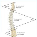 피네테스 이미지