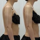 김포다이어트 예신관리 순환관리 베베영 솔직후기