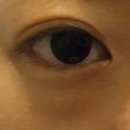 밥성형외과의원 이미지