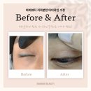 뷰티바비 | 오래된 지저분한 아이라인 수정 후기 - 바비뷰티에서 해결!