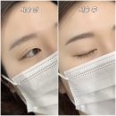 몽드뷰티 | 10년 만에 눈썹문신 재시술, 청라 라몽드뷰티 솔직후기 (내돈내산) 청라눈썹문신
