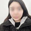 강남 땅콩형얼굴 쁘띠시술 후기( 팔자주름,심부볼)내돈내산