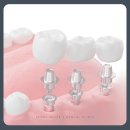 화이트디지털치과기공소 이미지