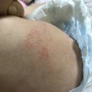 보니 이미지
