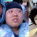 비포에프터 이미지