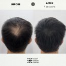 스칼프디자인센터 이미지