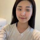 답십리 피부관리 쁨샵에서 스킨 플래닝 받았어요