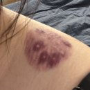 소호한의원 | 1월 | 30대 영국 워홀 32주차 ; 런던 두쫀쿠 카페 후기, 런던에 한국식 빵 살 수 있는 곳, 윔블던 라면...