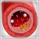 *** 콜레스테롤 이란? / 總整理 이미지