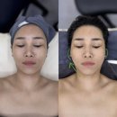 뷰티모텔 | [두암동피부관리] 퍼스널 에스테틱 윤슬뷰티에서 경험한 윤곽관리 리얼 후기