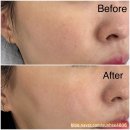 노란케어 119 | [리뷰] 🌿 동탄 더데이라운지 세라링 플래닝 후기 — 잔털, 피지, 노폐물까지 싹! 환절기 피부비수기 극복💧