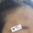 박피부과의원 이미지