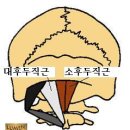 후두하근(Suboccipital muscles) 이미지