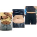 한주통상 | 용산다이어트병원 복부지방분해주사 효과 제로팻후기