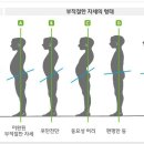 알즈너
