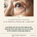 에스클래스성형외과의원 | 눈 밑 지방, 왜 생길까? 하안검 수술로 개선하는 방법