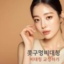 다르다면 | 콧구멍비대칭 치료 선천성 후천성 비대칭 교정후기