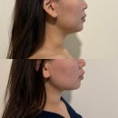 뉴코아아울렛 강남점 주차장 앞 횡단보도 | 강남구청 피부관리 맛집 리베아에스테틱에서 예신관리 받고왔어요! / 강남구청 피부관리 / 티리온엑스