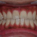 의정부본플란트치과의원 이미지