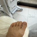 삼도메디칼 | 판교 발각질 제거 - 레푸스 분당판교점 홍윤주부원장님 추천해