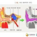 한쪽 귀 먹먹 증상, 원인 귀가 먹먹할 때 해결 예방 이미지