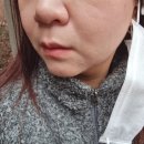 골드제이의원 | 선릉역피부과 골드제이의원 골드컷주사 시술3회차 후기예요