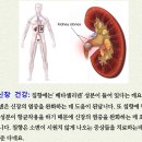 뇌졸중방지침향 - 침향나무효능 이미지