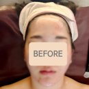 보트리샤 | 대구 롯데백화점 보트리샤 루시도르 줄기세포 엑소테라피 후기