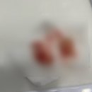 사랑치과의원 | 사랑니발치병원후기 x 사랑이아프니치과의원 홍대점