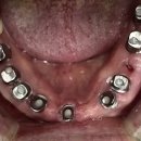 백치과기공소 이미지