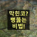 번성세탁 | 비염 증상 완화하는 방법