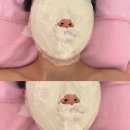 호매실 피부관리 별하에스테틱에서 윤곽관리 받고 온 후기
