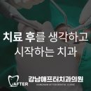 강남애프터치과 이미지