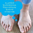 무지외반증은 발가락운동용구 듀트 착용하고 걷고 운동하여 개선하세요 이미지